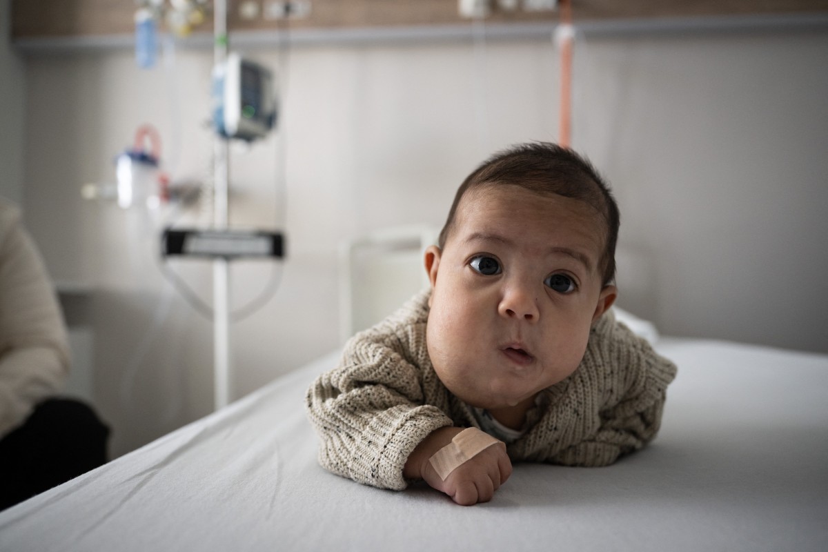 Un bebé con un tumor vascular que ponia en riesgo su vida fue tratado intrauterinamente con éxito