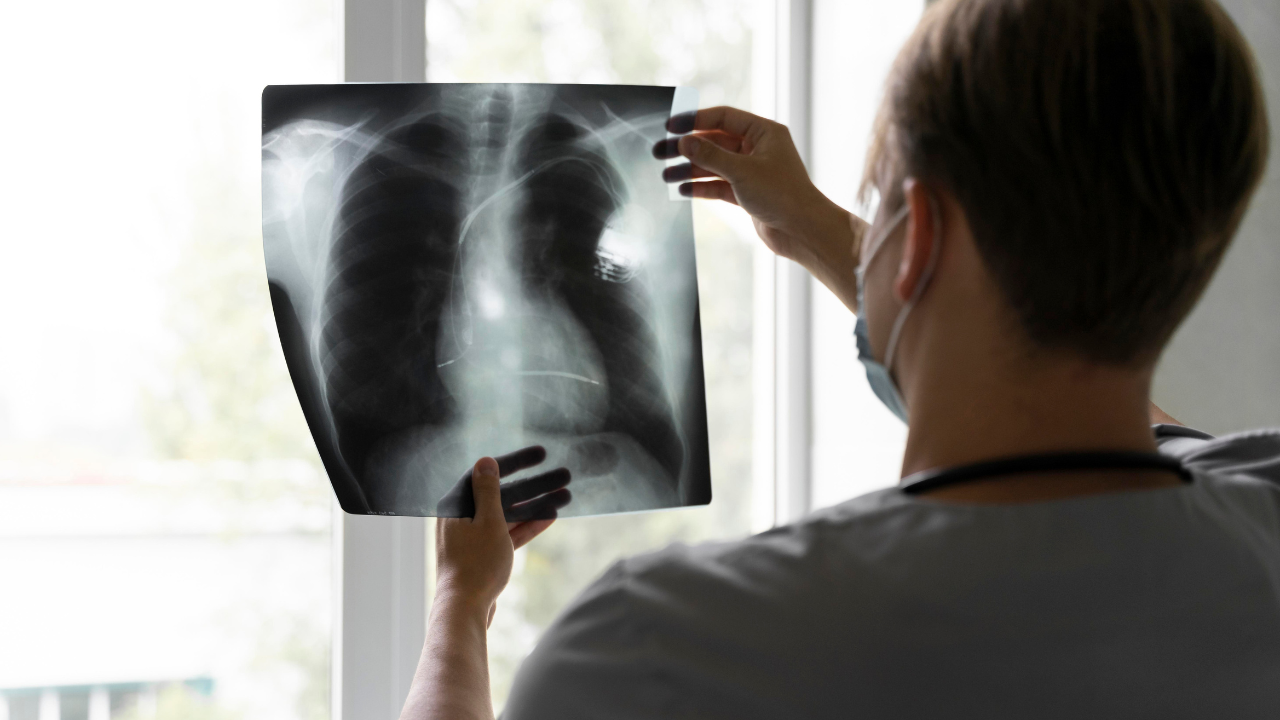 Un tercio de los casos de tuberculosis de Ecuador están en las cárceles