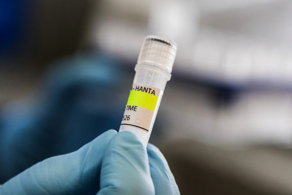 Un brote de 2018 en Argentina da pistas sobre cómo se propaga el hantavirus