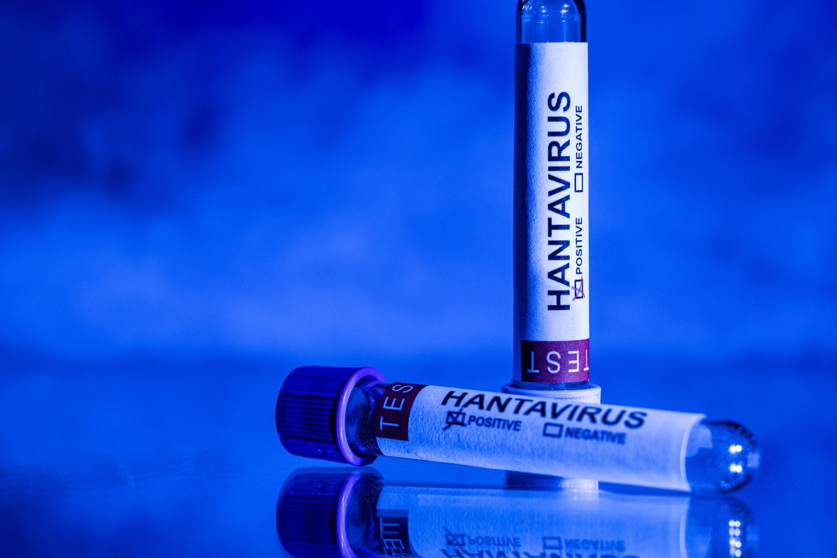 La OMS pide a los países que sigan sus «directrices» para frenar el hantavirus